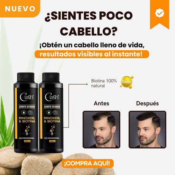 Shampoo Minoxidil Contra La Caída Estimula El Crecimiento Del Cabello