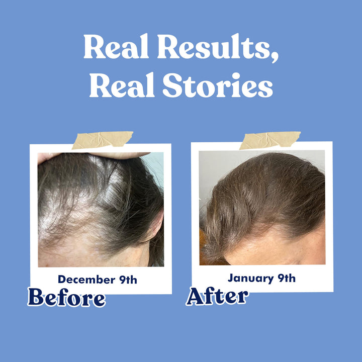 Biotina 20000 Mcg Queratina Coco Zinc 120 Cap Cabello Uñas Saludable - Imagen 5