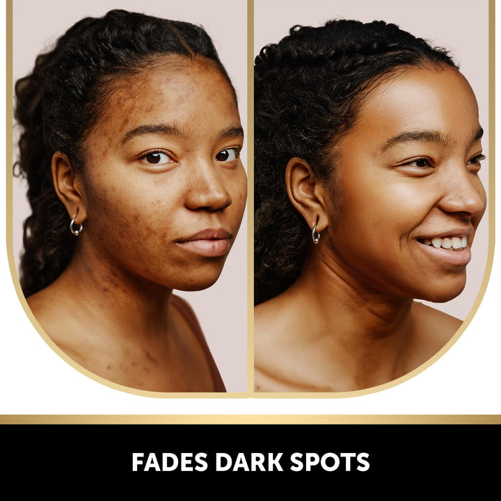 Jabon Valitic Blanqueadora Con Acido Kojico Y Vitamina C Potente Limpieza - Imagen 2