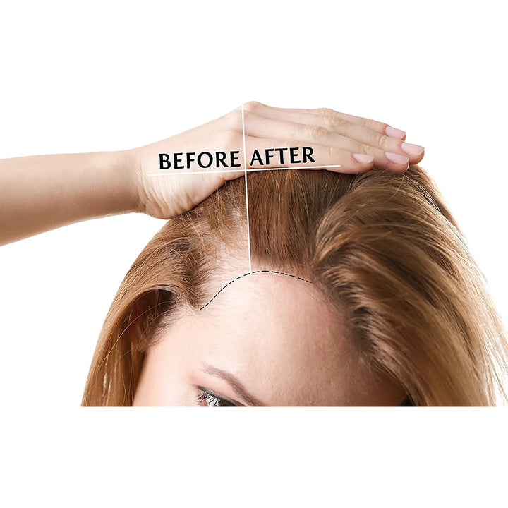 Aceite De Coco Fraccionado Puro Mct 473 Ml Totalmente Natura Fragancia - Imagen 6