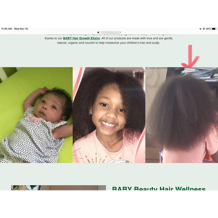 Aceite Orgánico Para Crecimiento Cabello Bebé Con Coco Oliva - Imagen 4