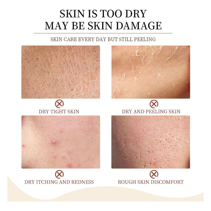 Aceite De Coco Orgánico Para Hidratación Facial Antienvejeci Fragancia - Imagen 2