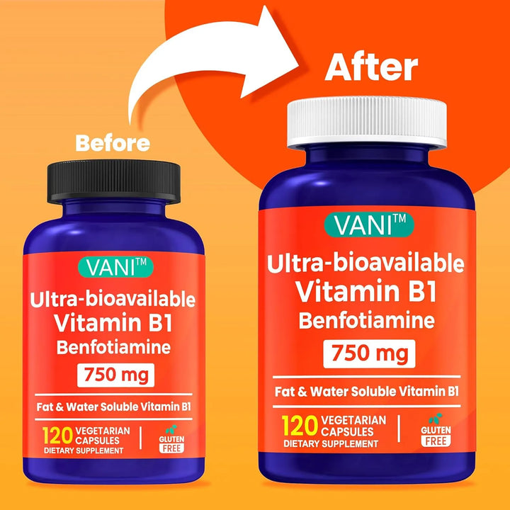 Benfotiamina 750 Mg Con Tiamina B1 Soluble En Agua Y Grasa E - Imagen 2