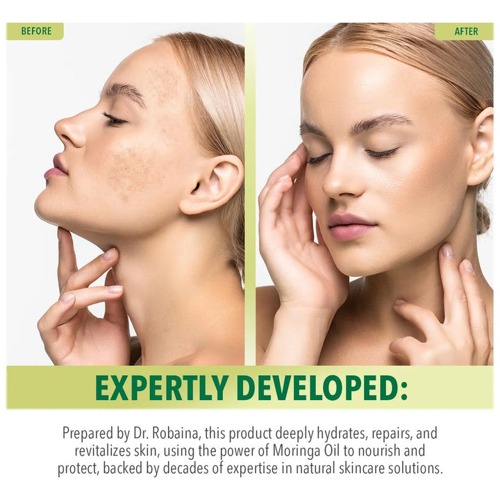 Aceite De Moringa Puro Hidratación Profunda Reparación Piel - Imagen 5