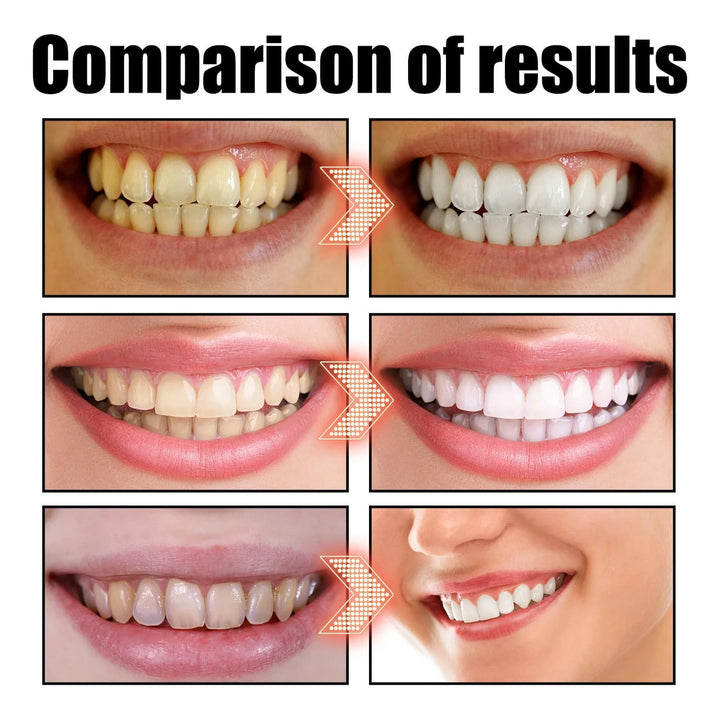 Aceite De Coco Natural Blanqueador Dental Frescura De Menta Fragancia - Imagen 5