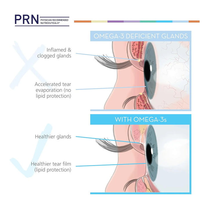 Aceite De Pescado Omega 3 Para Ojos Secos 2240 Mg Epa Dha Fó - Imagen 3