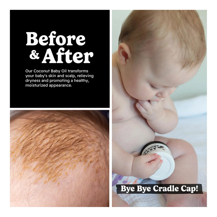 Aceite De Coco Orgánico Para Bebé Cuidado Capilar Y Cutáneo - Imagen 5
